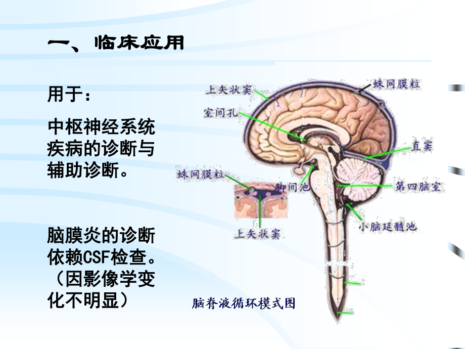 CSF脑脊液检查.ppt_第2页