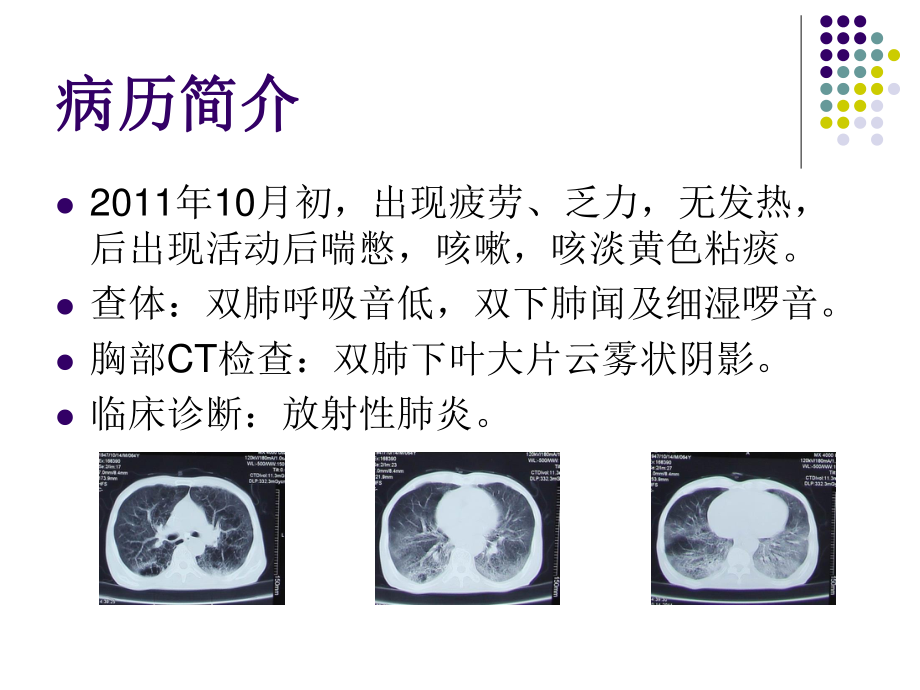 卡氏肺囊虫.ppt_第3页