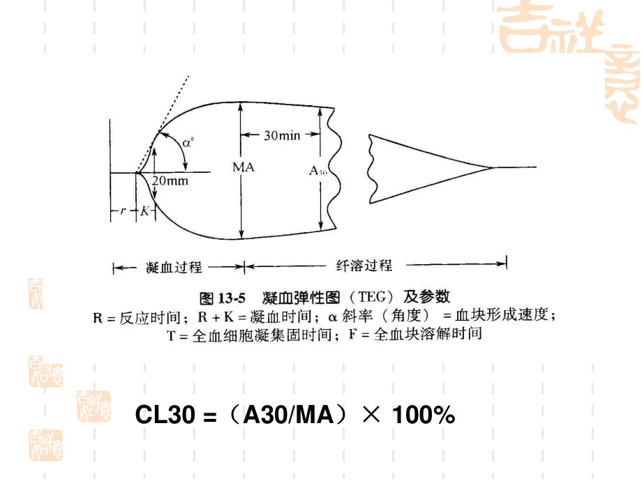 判定使用抗血小板药氯吡格雷.ppt_第2页