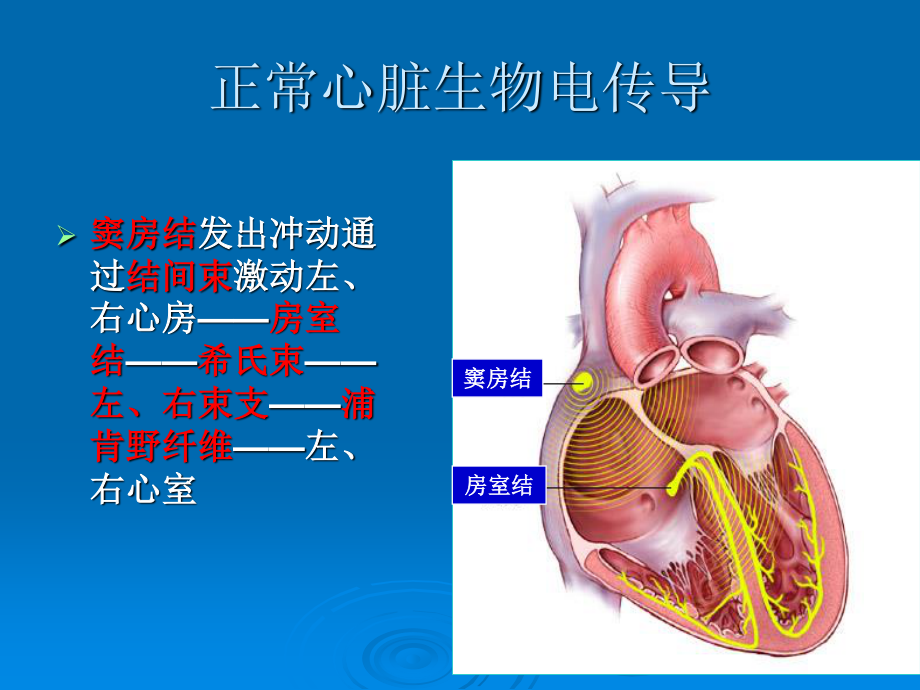 人工心脏起搏器.ppt_第3页