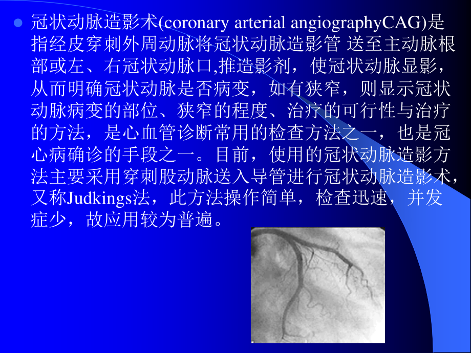 冠状动脉造影术的术前及术.ppt_第2页