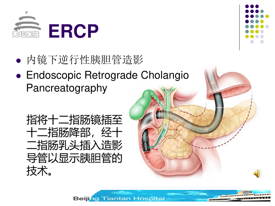 内镜下逆行性胰胆管造影.ppt_第2页