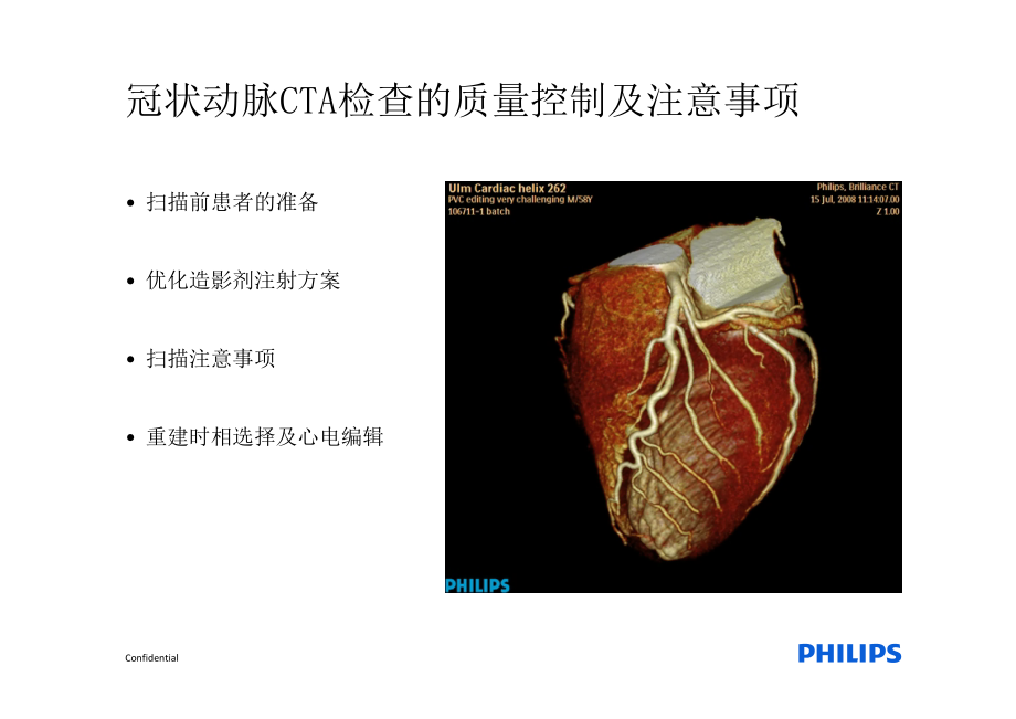 冠状动脉CTA检查质量控制.pdf_第3页