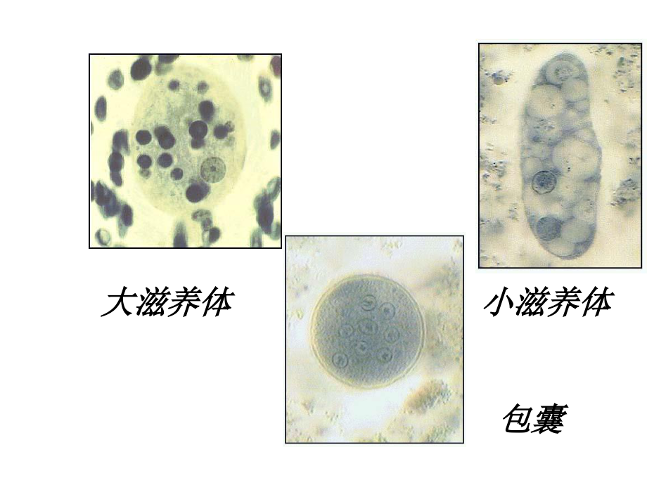 [所有分类]抗阿米巴虫驱肠虫药.ppt_第2页