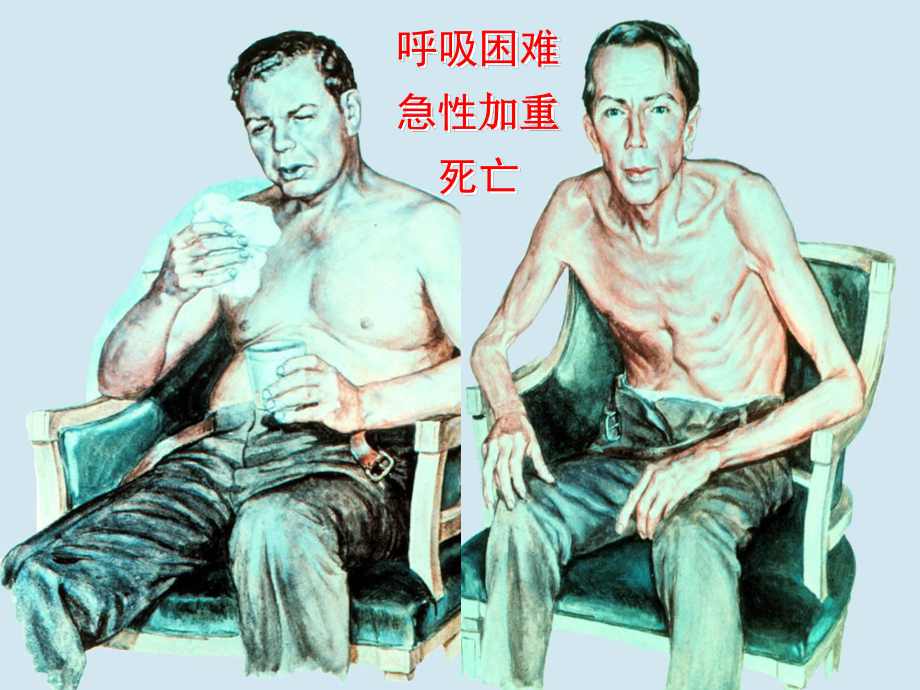 COPD多媒体医院讲课2.ppt_第3页