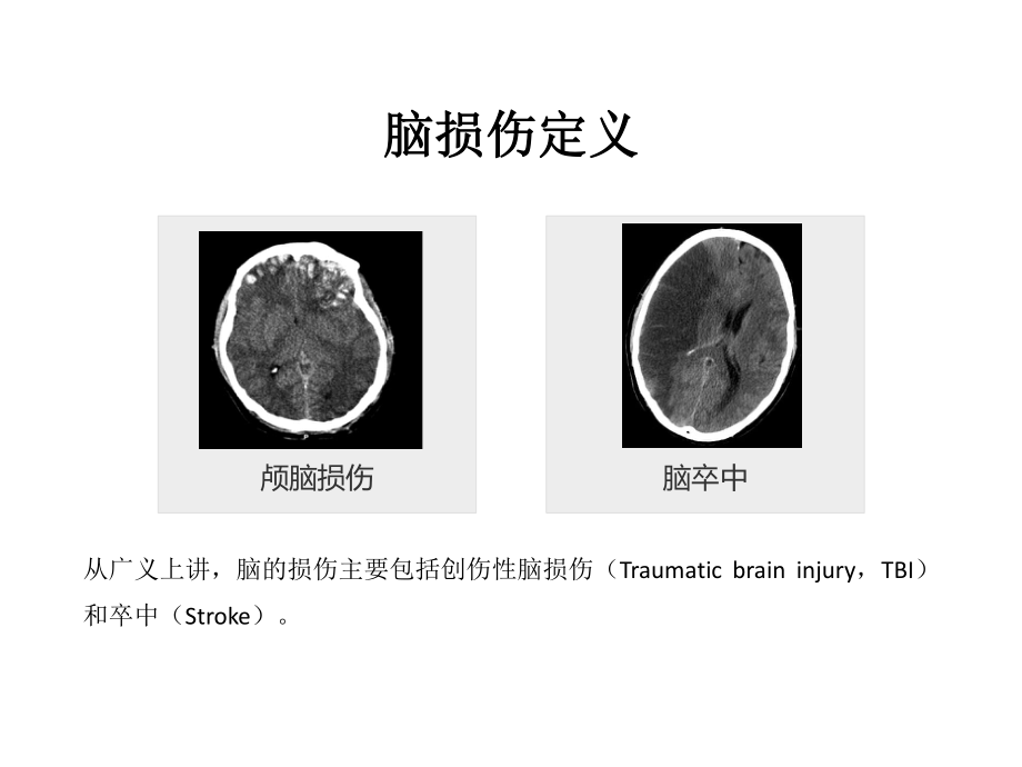 NGF与认知功能障碍.pptx_第2页