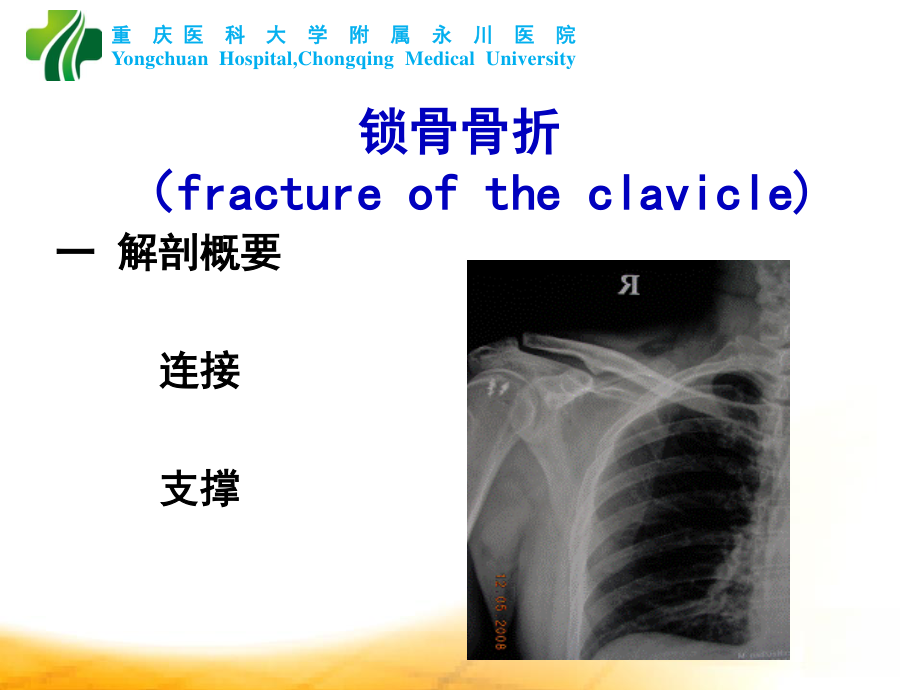 上肢骨折脱位.ppt_第2页