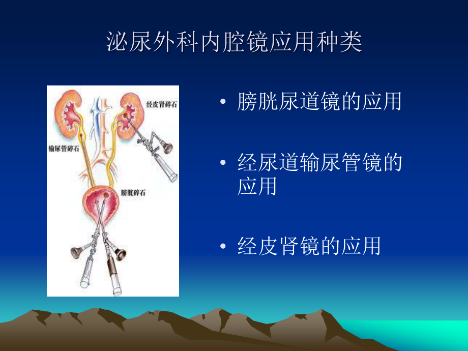 内镜在泌尿外科的应用.ppt_第3页