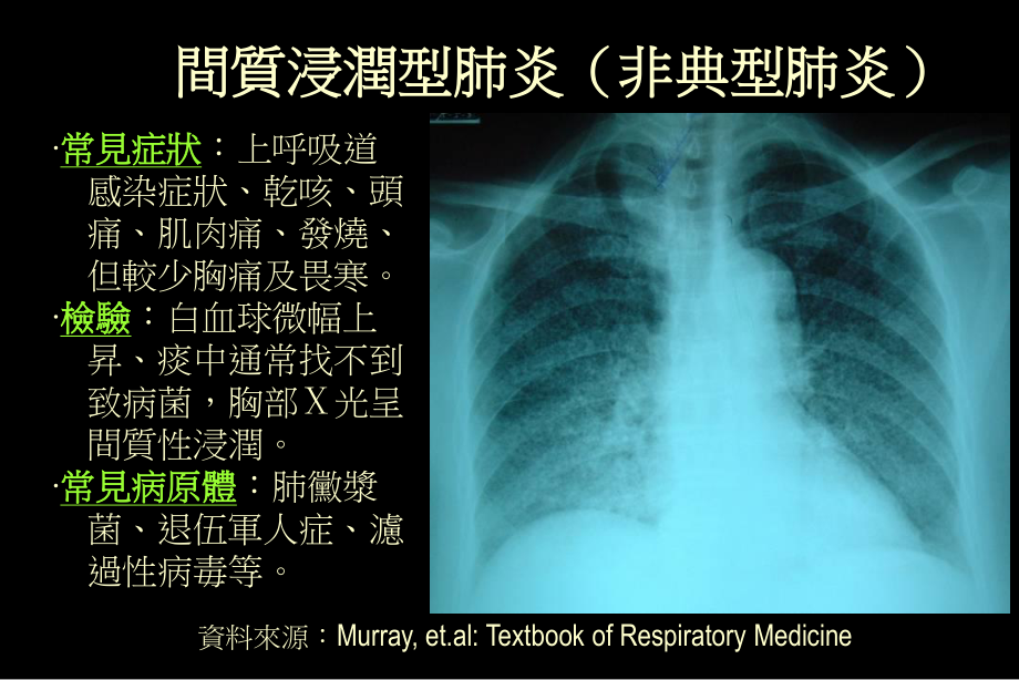 严重急性呼吸道症候群.ppt_第3页