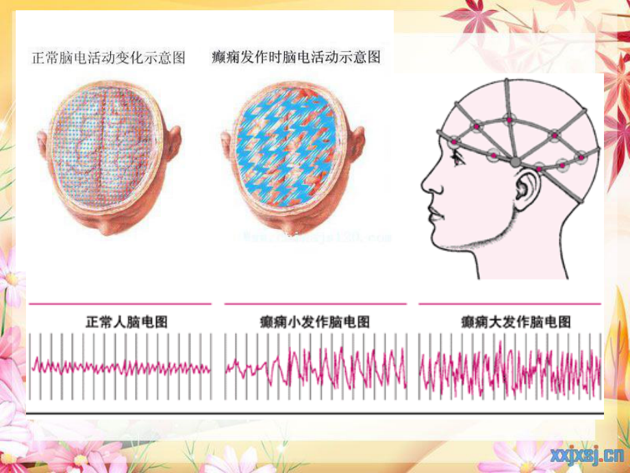 cq13-抗癫痫、抗惊厥药解读.ppt_第3页