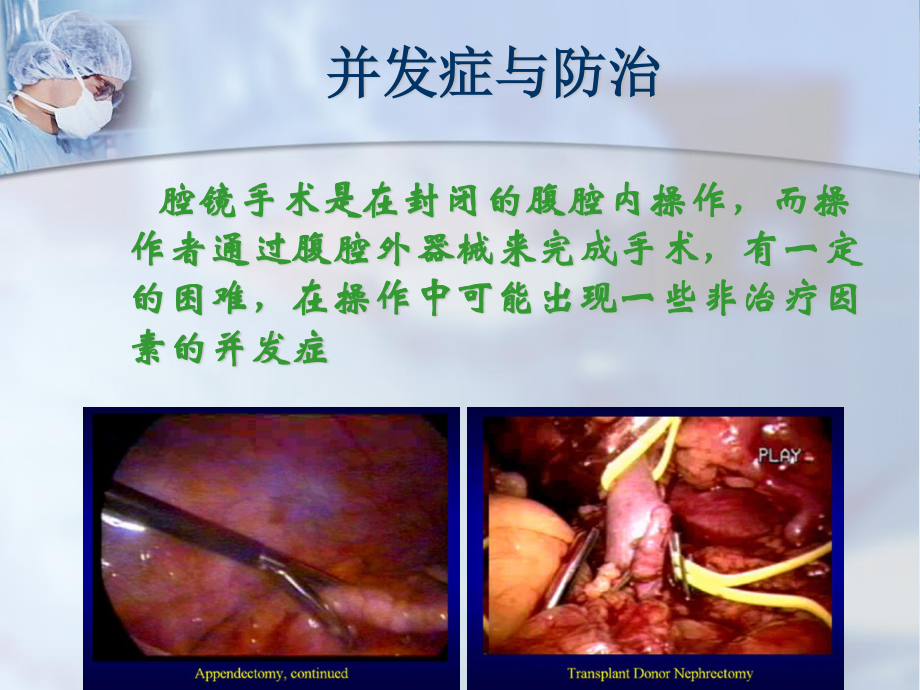 5[1].手术并发症与防治原始(from-Prof.Li-Hong).ppt_第2页