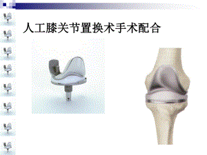 人工膝关节置换术手术配合ppt..ppt