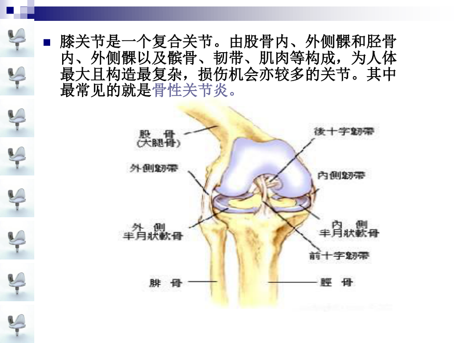 人工膝关节置换术手术配合ppt..ppt_第3页