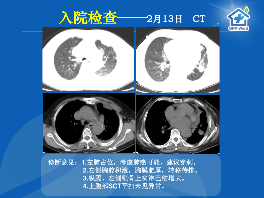 5-16癌痛病例分享(郑大一附院王峰).ppt_第3页