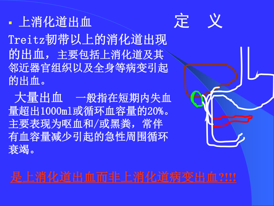 上消化道出血的处理(武希润).ppt_第2页