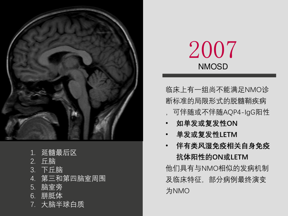 中国NMOSD诊治指南2015.ppt_第3页