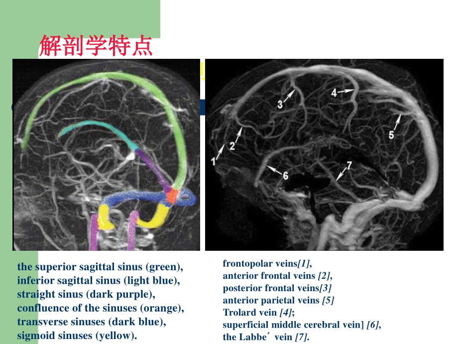 AHA-静脉血栓形成20130519.ppt_第3页