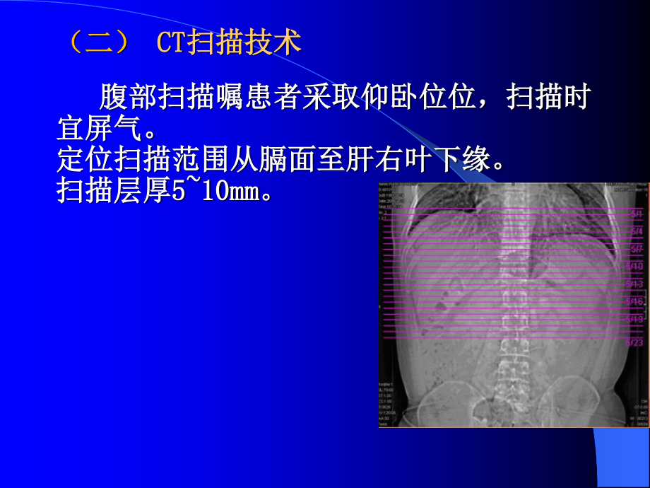 上腹部CT(肝胆脾胰)检查技术.ppt_第3页