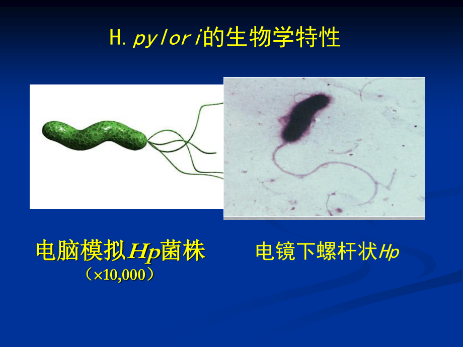 依赖于胃镜活检快速尿素酶试验RUT.ppt_第2页