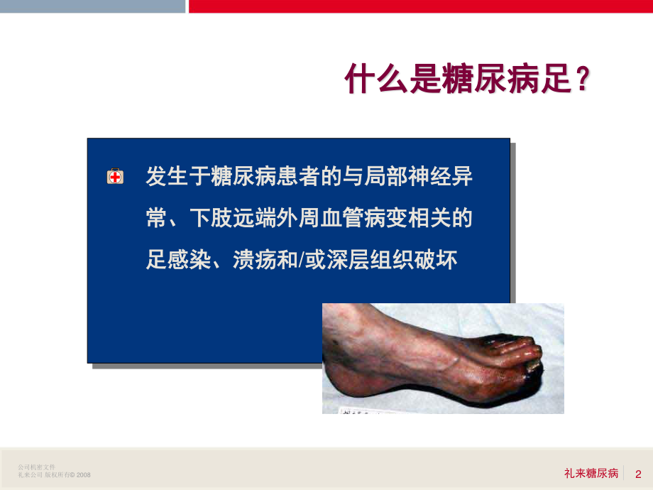 6糖尿病足赵小涛.ppt_第2页