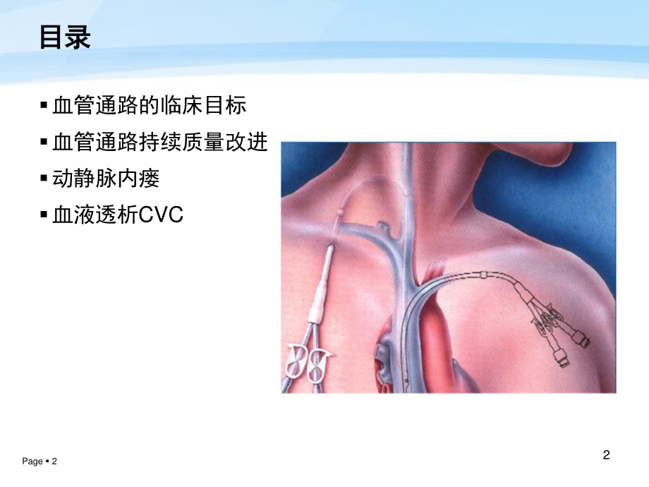 中国血液透析用血管通路专家共识.ppt_第2页