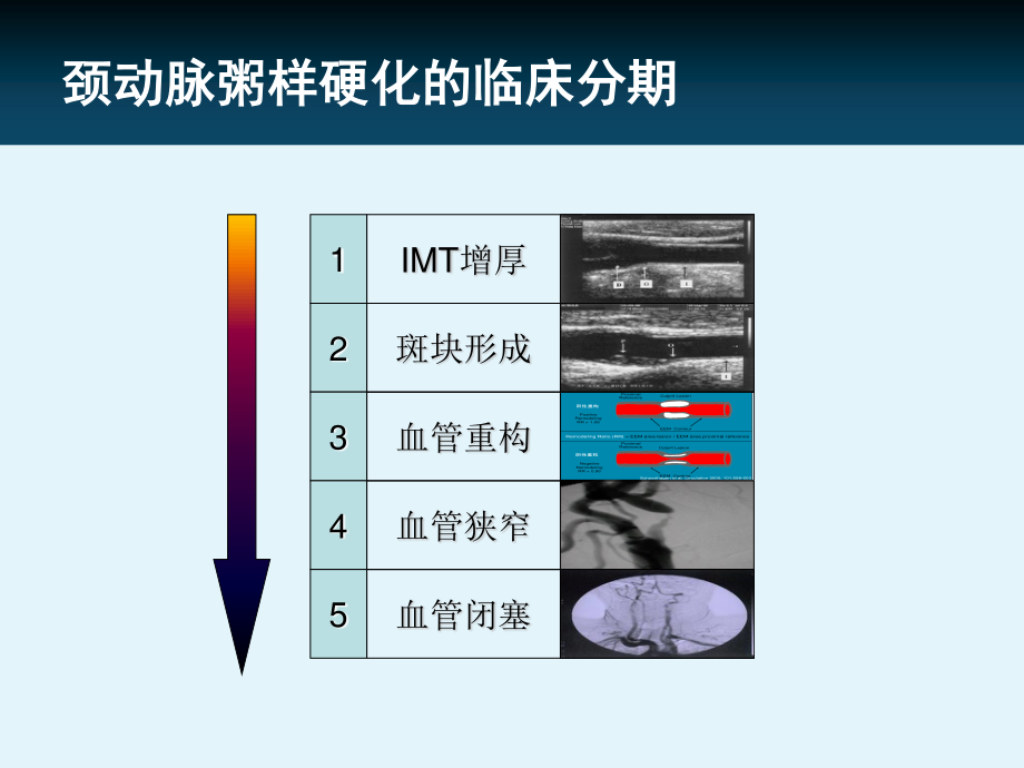 他汀在颈动脉粥样硬化中的证据.ppt_第3页