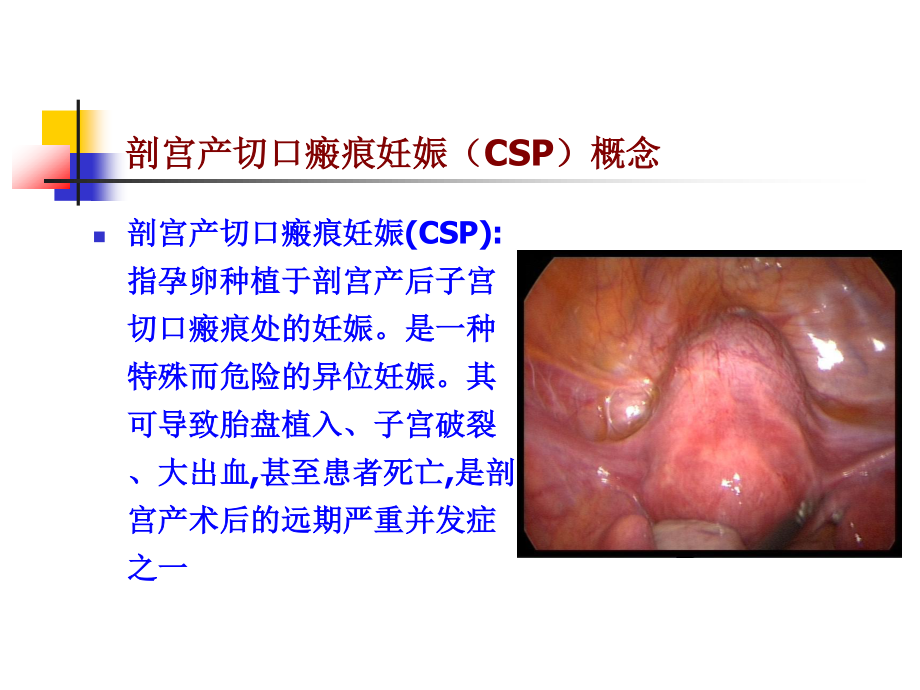 切口妊娠214年10月.ppt_第2页