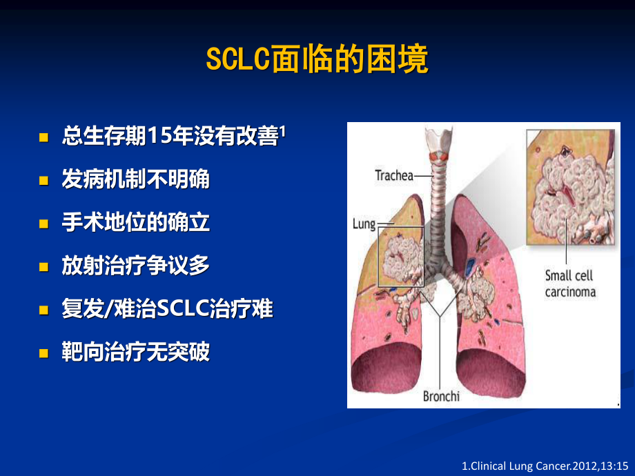 CSCO小细胞肺癌.ppt_第1页