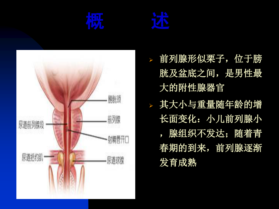 前列腺炎诊疗现状与进展.pptx_第3页