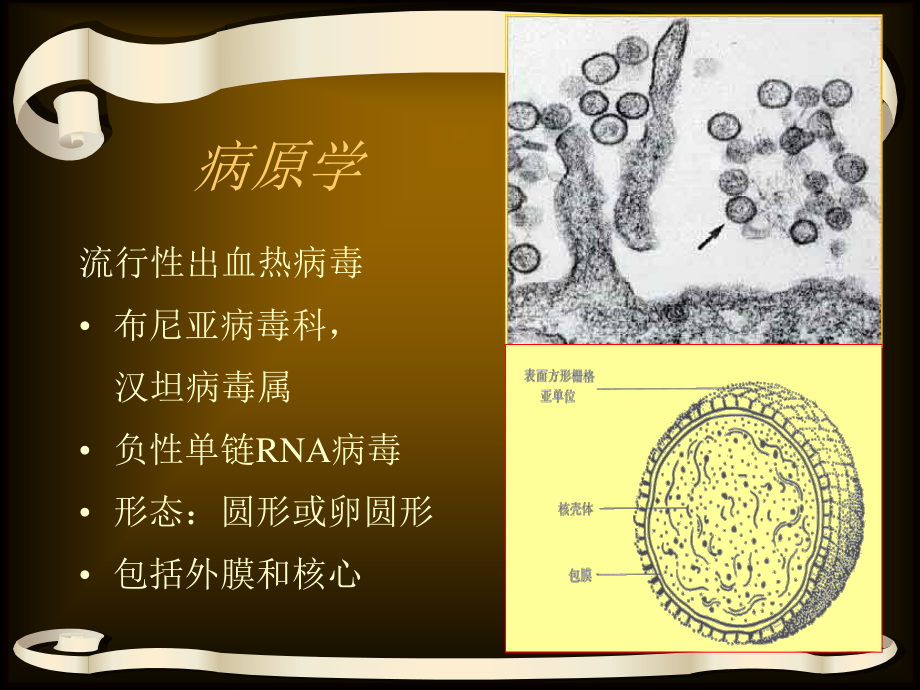 EHF-流行性出血热.ppt_第3页