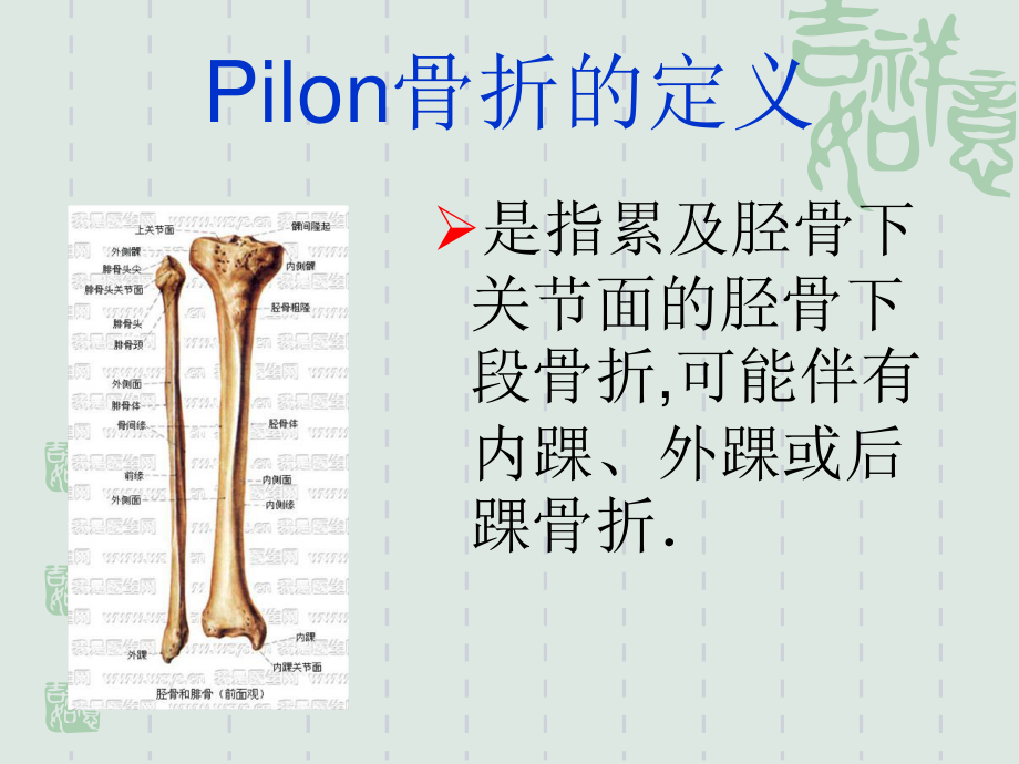 Pilon骨折的诊治现状与进展.ppt_第2页