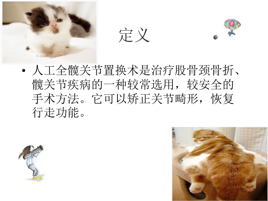 全款关节置换术后功能锻炼.ppt_第2页