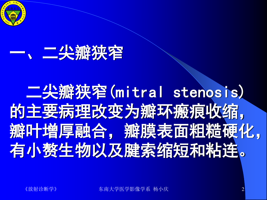 二尖瓣狭窄心脏增大呈梨形左心房和右心室增大肺淤血.ppt_第2页