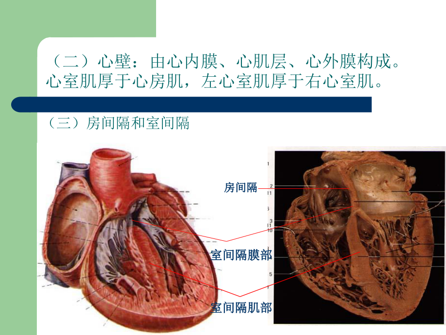 七-心脏粘液瘤.ppt_第3页