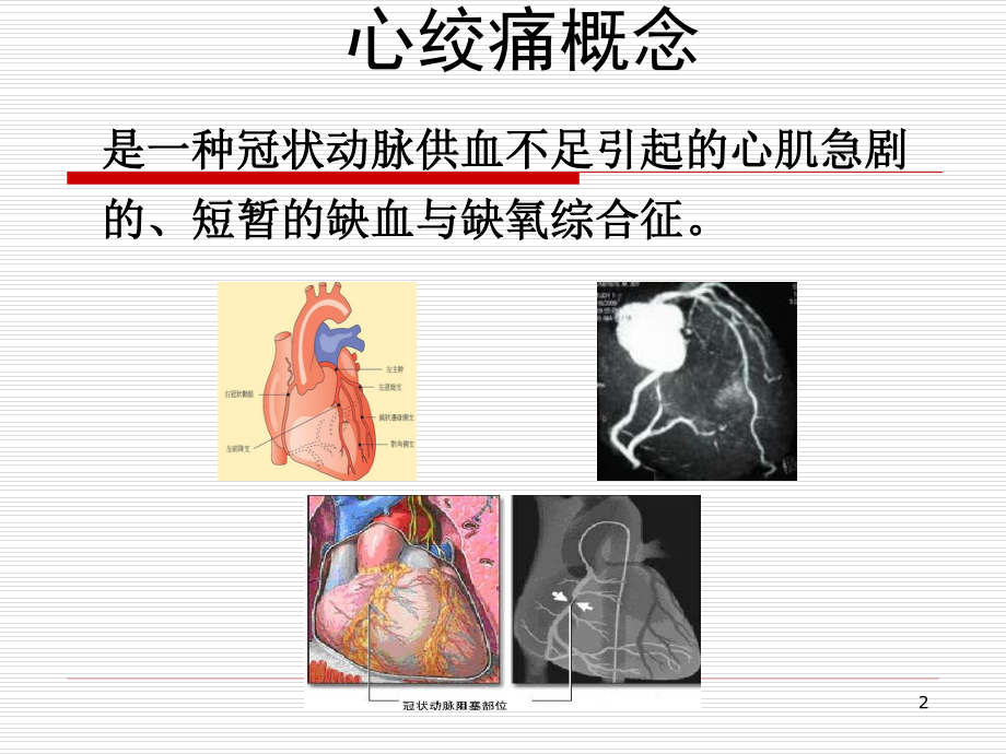 6抗心绞痛药应用.ppt_第2页