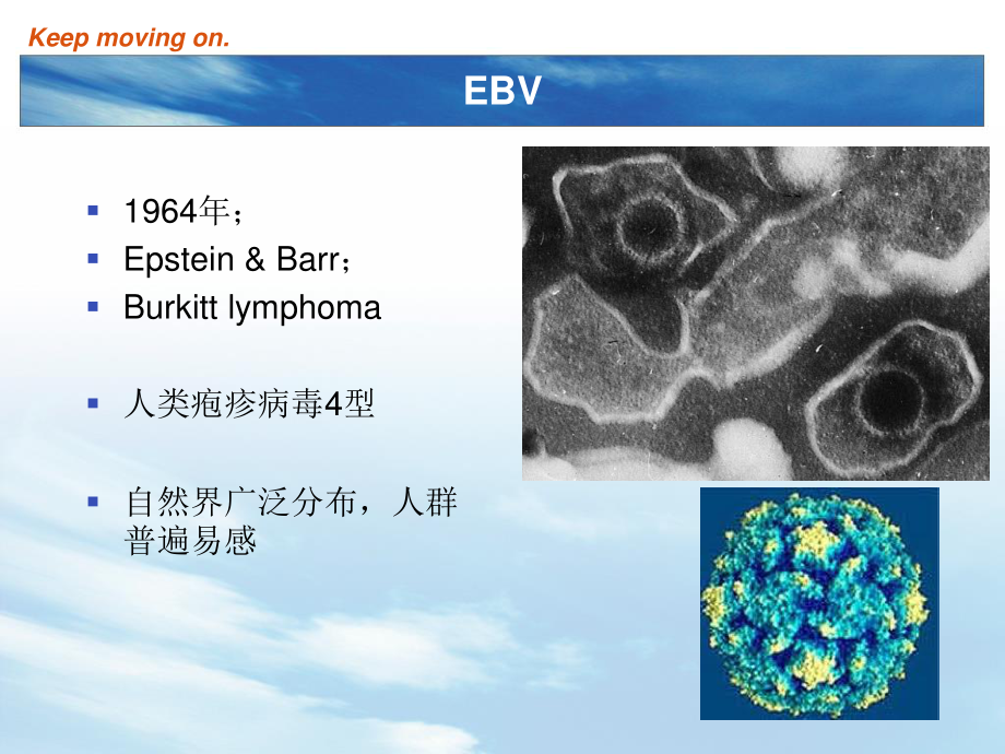 EBV及传染性单核细胞增多症.ppt_第3页