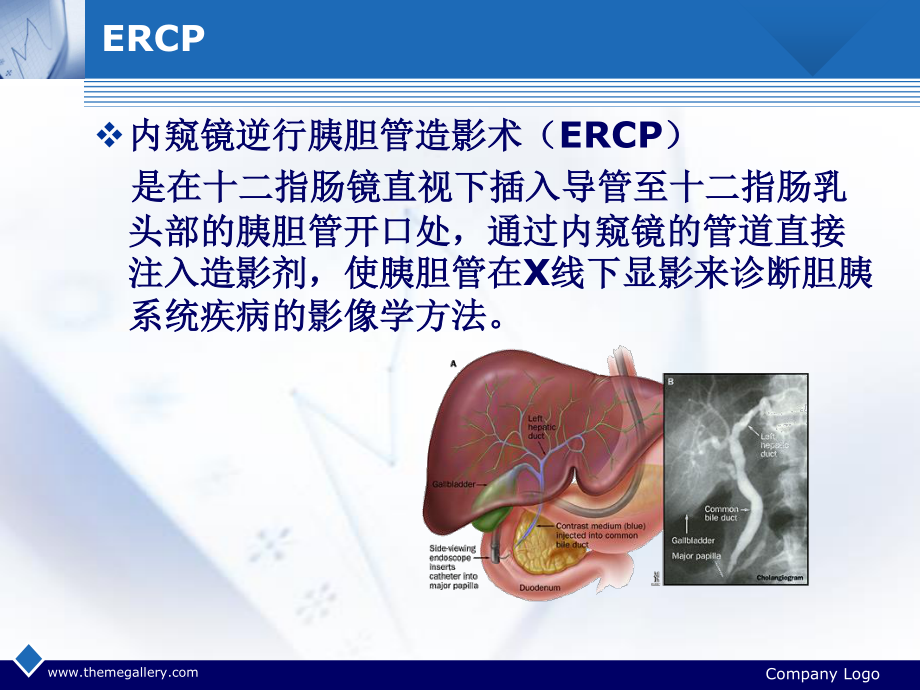 ERCP诊疗与并发症.ppt_第2页