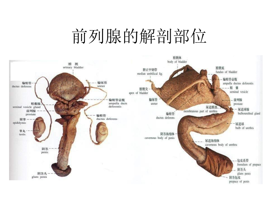 前列腺增生症.ppt_第2页