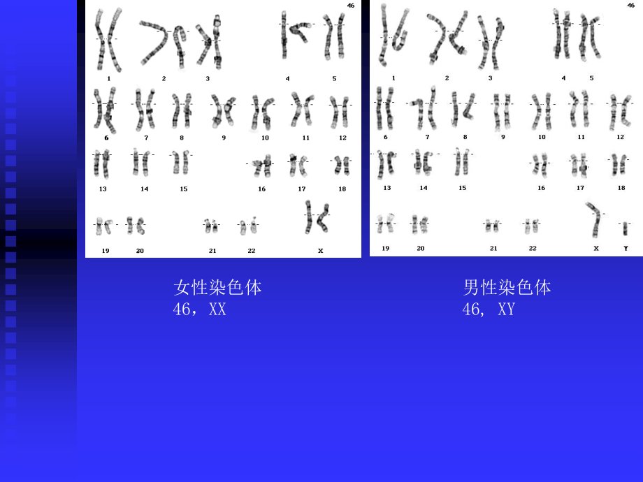 人类染色体和染色体病.ppt_第3页