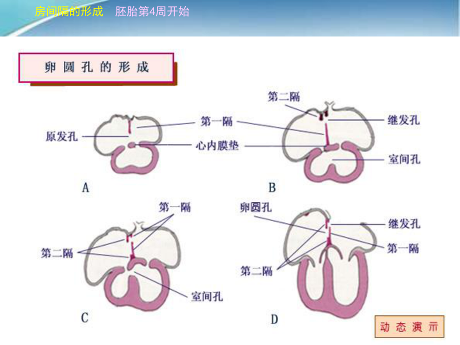 儿童先天性心脏病.ppt_第3页