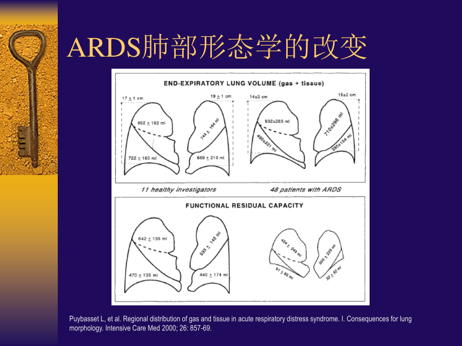 ARDS患者的肺复张-nursing.ppt_第3页