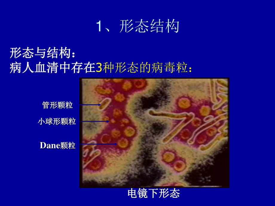 HBV-X-蛋白与原发性肝癌.ppt_第3页