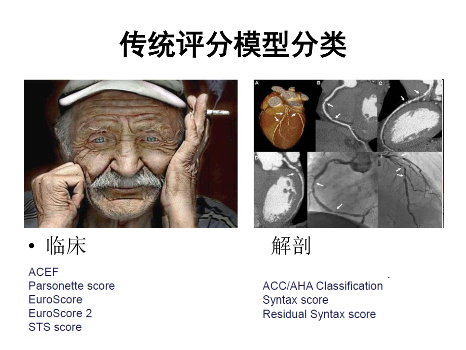 冠心病危险评分与决策N.ppt_第3页