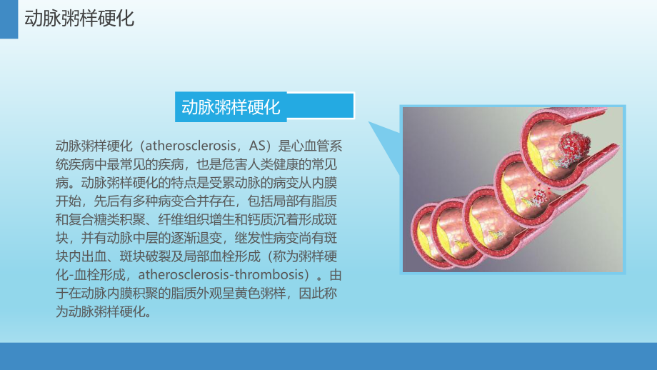 动脉粥样硬化.pptx_第3页