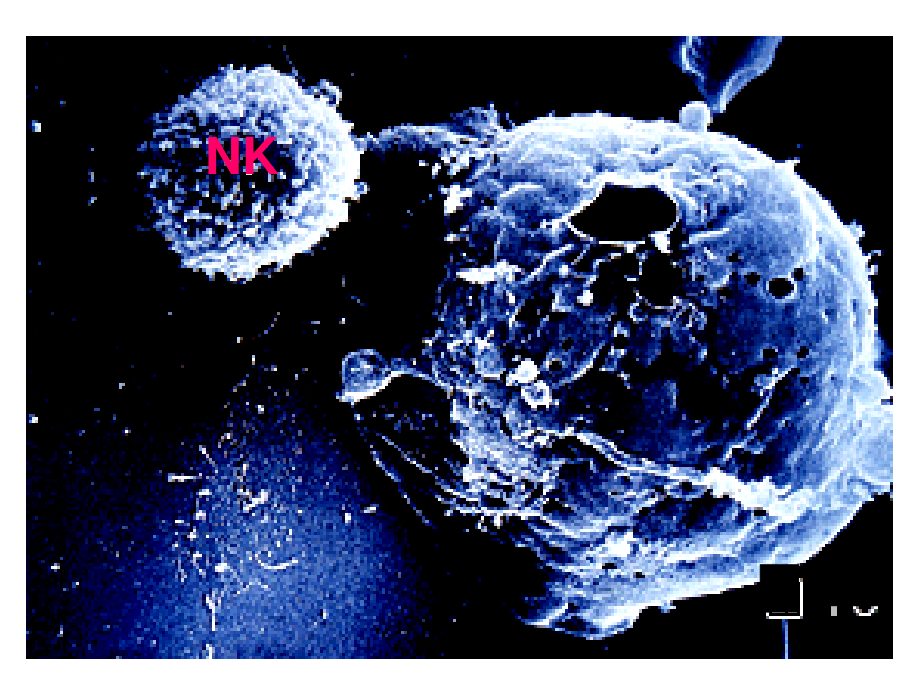 NK细胞(2010上).ppt_第3页