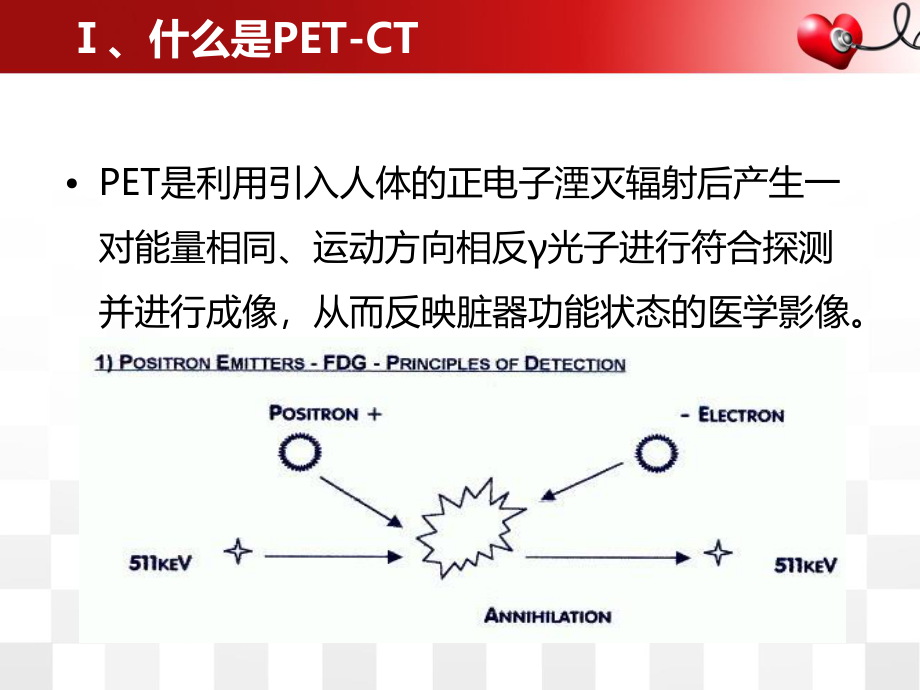 PET-CT在消化系统应用.ppt_第2页