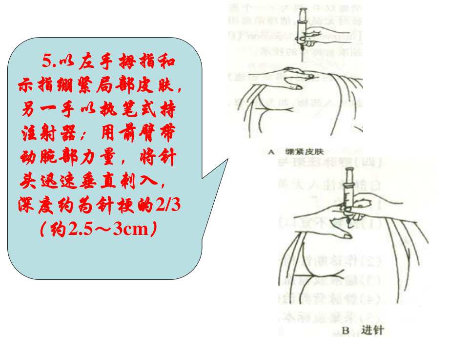 5以左手拇指和示指绷紧局部皮肤-另一手以执笔式持注射器.ppt_第2页