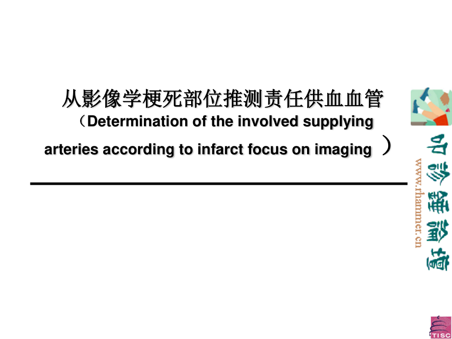 从影像学梗死部位推测责任供血血管.ppt_第1页