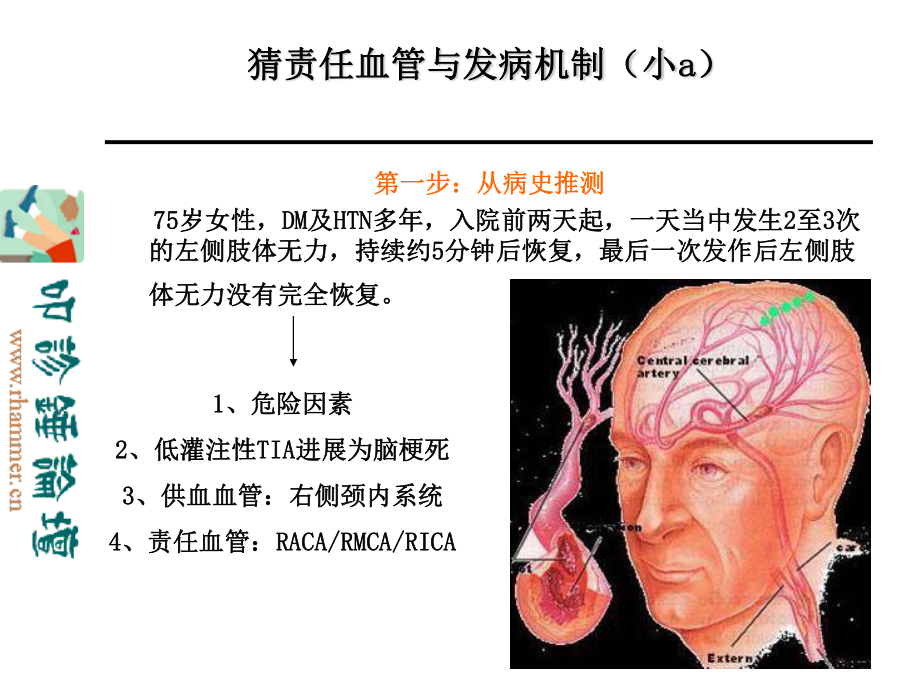 从影像学梗死部位推测责任供血血管.ppt_第2页