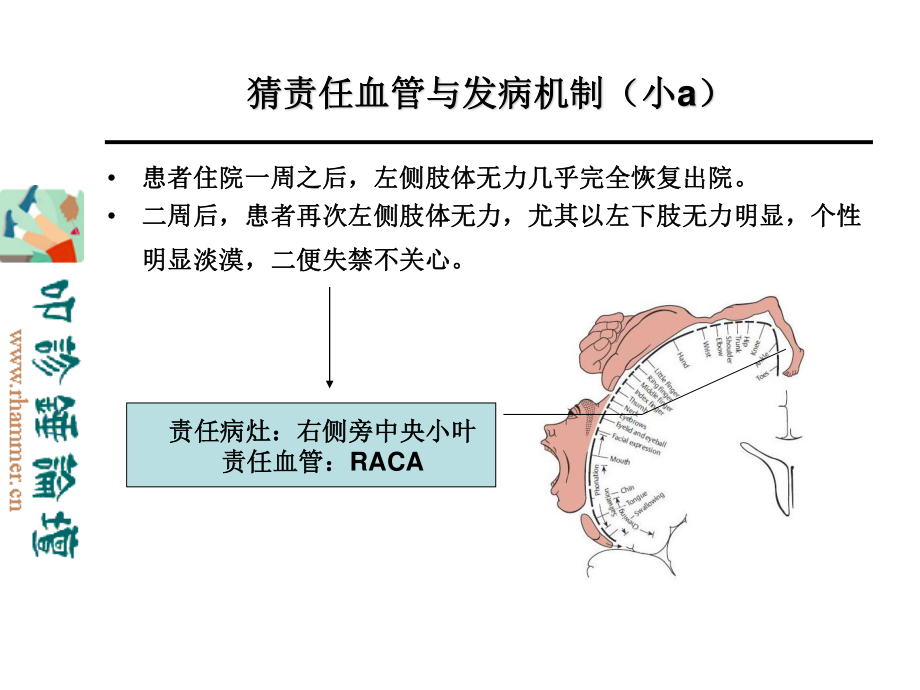 从影像学梗死部位推测责任供血血管.ppt_第3页